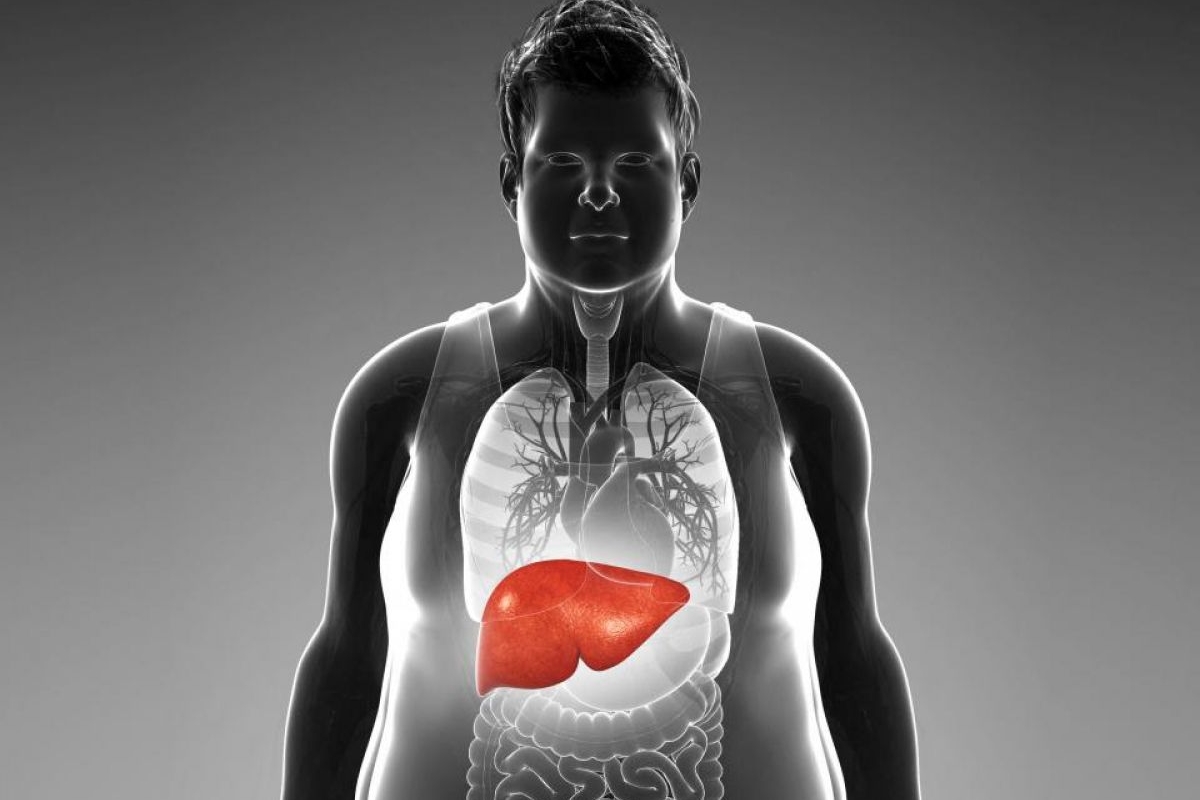 Fatty liver disease a silent threat to your health News Minimalist