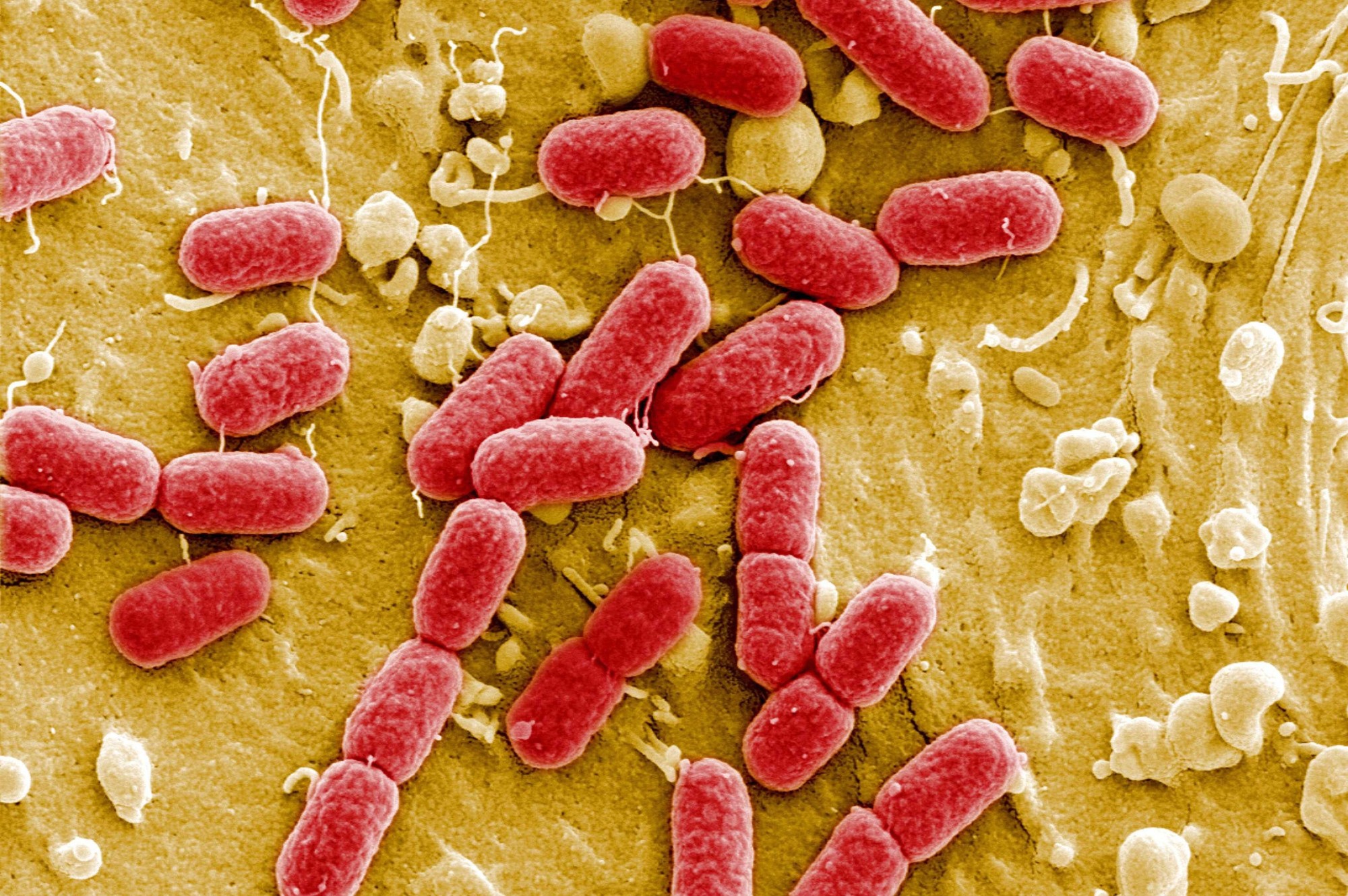 Une bactérie ultrarésistante se propage en Europe Une bactérie ultrarésistante se propage en Europe