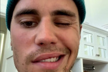 Justin Bieber est atteint du syndrome de Ramsay Hunt