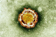 Le coronavirus vu au microscope (archive).