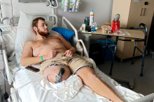 Wilson, amputé après un accident dans un parc aquatique du Jura