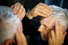 Illustration perte de cheveux