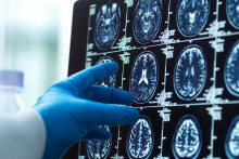 Illustration d'un docteur étudiant des scans de patients afin de détecter la maladie d'Alzheimer