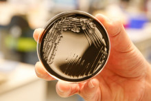 Culture de la bactérie Legionella pneumophila à l'hôpital UZ Gent, en Belgique