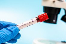 Un est sanguin de dépistage des anticorps antirabiques qui détecte les anticorps contre le virus de la rage