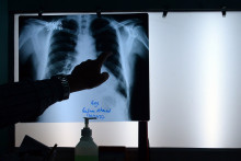 Une radiographie (illustration)