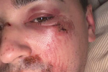 Kilian Froelhy a posté un message sur les réseaux sociaux dans lequel il dénonce une agression homophobe.
