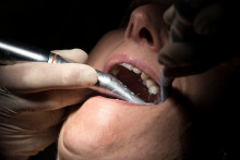 Une patiente chez un dentiste (illustration)