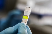 Un scientifique de l'Institut Malbrán tenant un tube à essai utilisé pour diagnostiquer le hantavirus