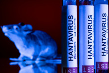 L'hantavirus des Andes (image d'illustration)
