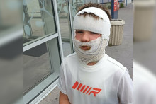 Melvyn, le petit garçon de 8 ans qui a été grièvement brûlé par le gel contenu dans une balle anti-stress squishy.