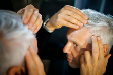 Un homme en train de perdre ses cheveux. (Illustration)