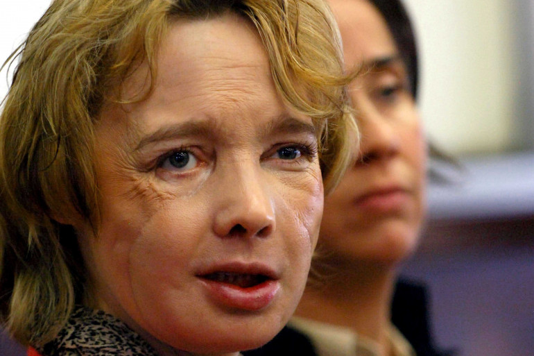 Isabelle Dinoire en 2006