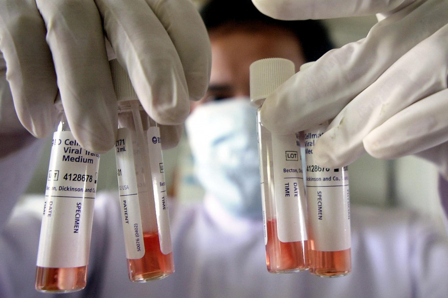 La Fatigue Chronique N Est Pas Psychologique