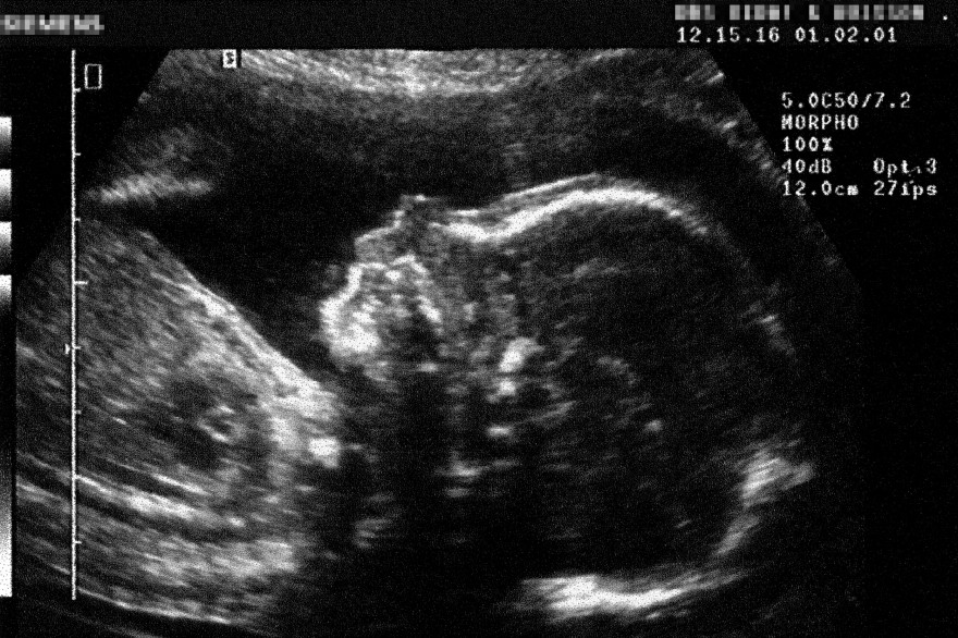 Une échographie de foetus (photo d'illustration)