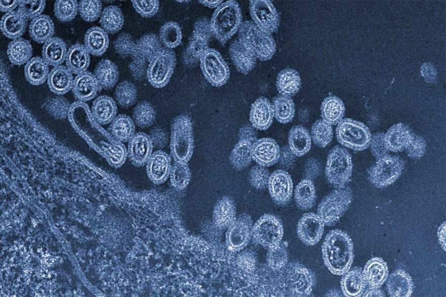 Un nouveau virus au génome inconnu découvert au Brésil Un nouveau virus au génome inconnu découvert au Brésil