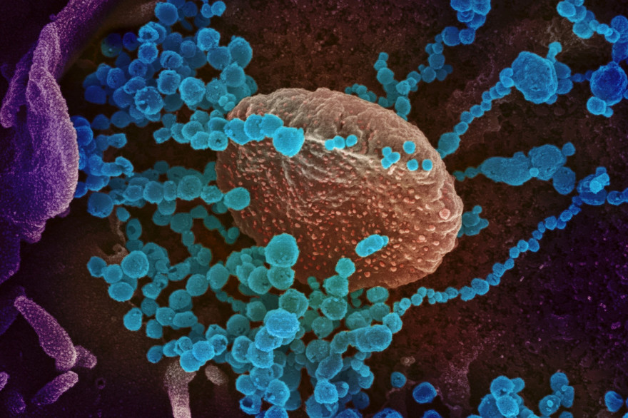 Le SARS-CoV-2 observé au microscope électronique (en bleu sur cette image)
