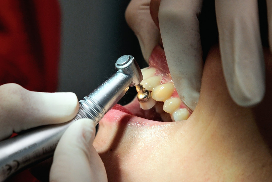Le bon remboursement des soins dentaires est une des garanties optionnelles à vérifier.