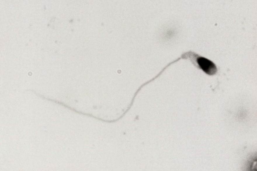 Un spermatozoïde (Illustration)