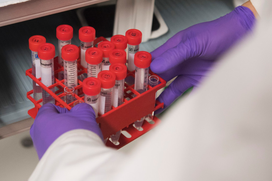 Les cellules des patients doivent être modifiées en laboratoire