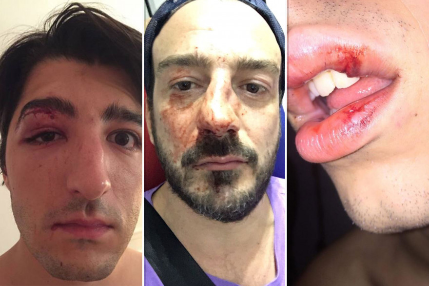 Les témoignages d'agressions homophobes se multiplient sur les réseaux sociaux
