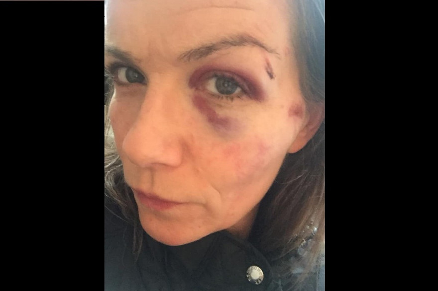Une femme a été agressée à Paris le soir d'Halloween alors qu'elle embrassait sa compagne.