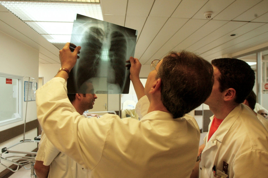 Des médecins analysant une radio des poumons (illustration)